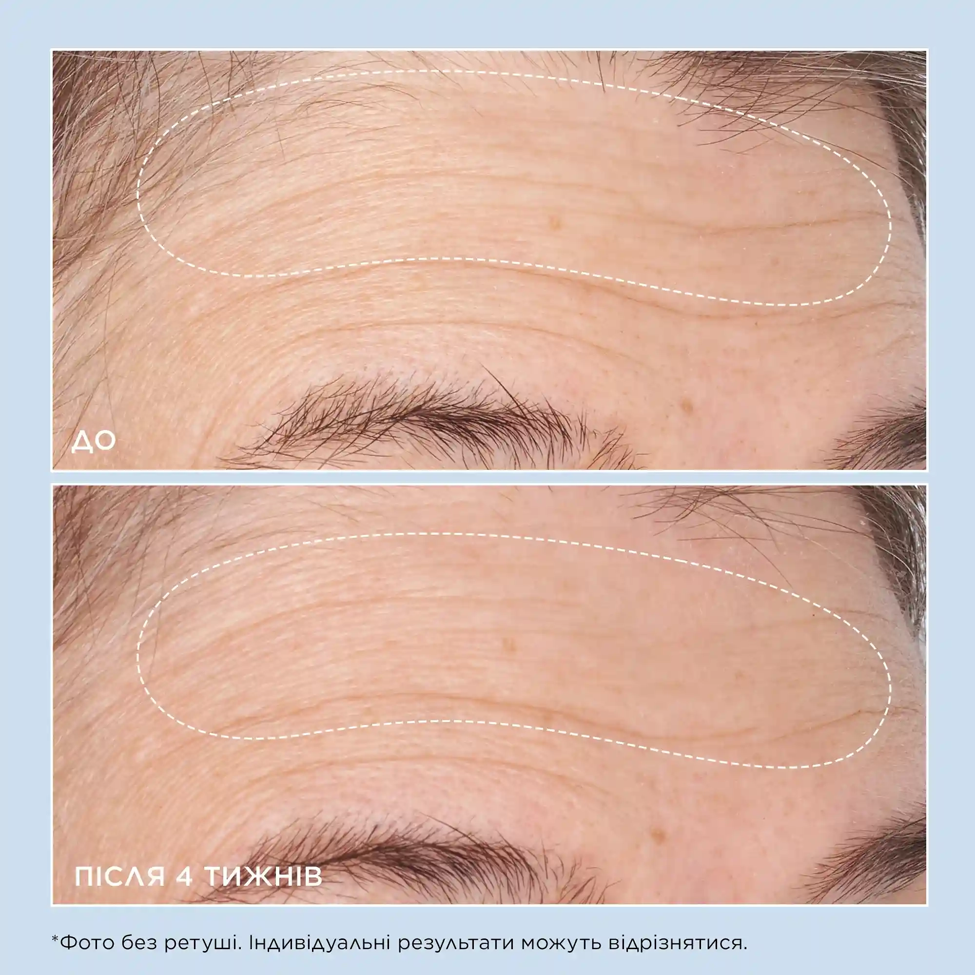 COLD PLASMA PLUS+ ADVANCED HYDRATING COMPLEX - 3 - Perricone MD
