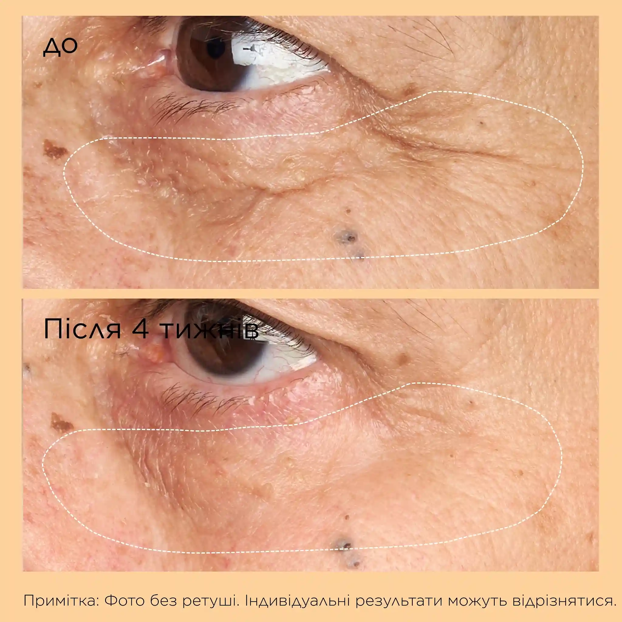 NEUROPEPTIDE CORRECTIVE BRIGHTENING UNDER-EYE CREAM - 4 - Perricone MD