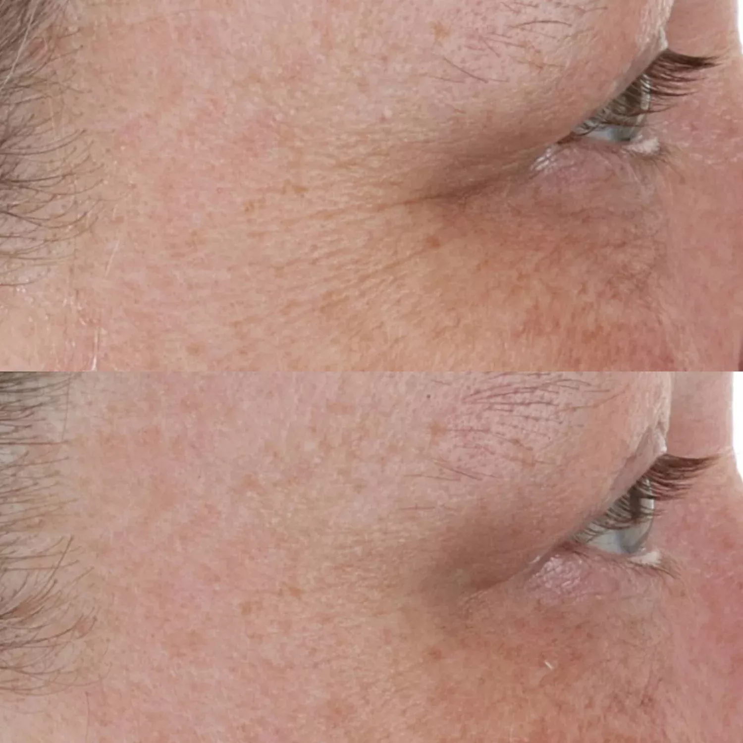 HIGH POTENCY RETINOL RECOVERY OVERNIGHT MOISTURISER - 4 - Perricone MD