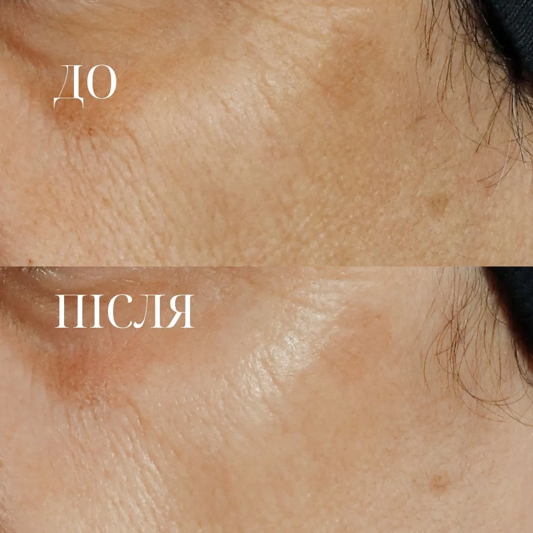 HIGH POTENCY TRIPLE RETINOL RENEWAL SERUM - 3 - Perricone MD