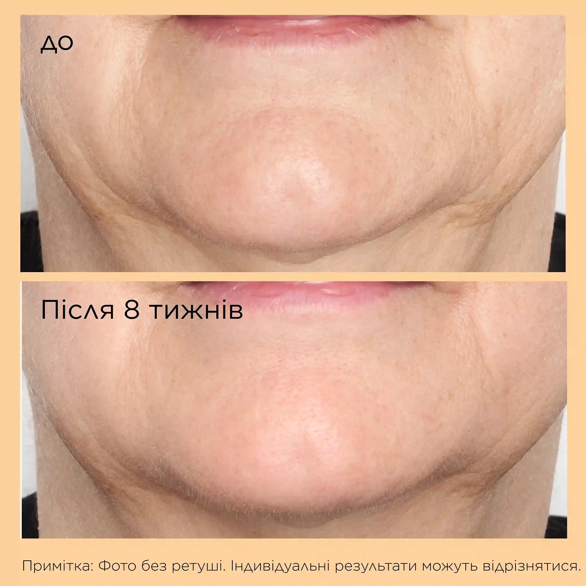 NEUROPEPTIDE DEEP CREASE SERUM - 5 - Perricone MD
