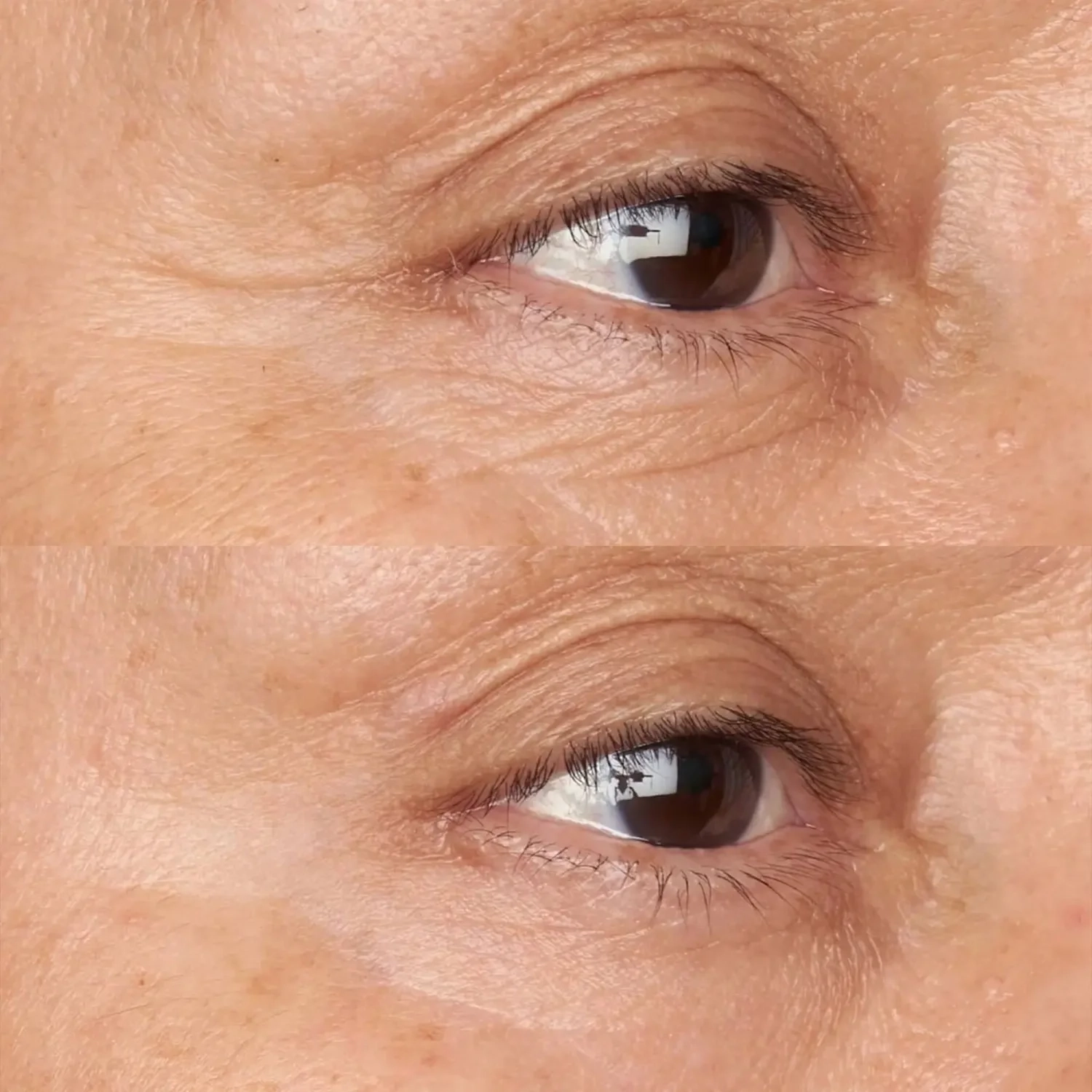 HYPOALLERGENIC CLEAN CORRECTION FIRMING & BRIGHTENING EYE CREAM - 4 - Perricone