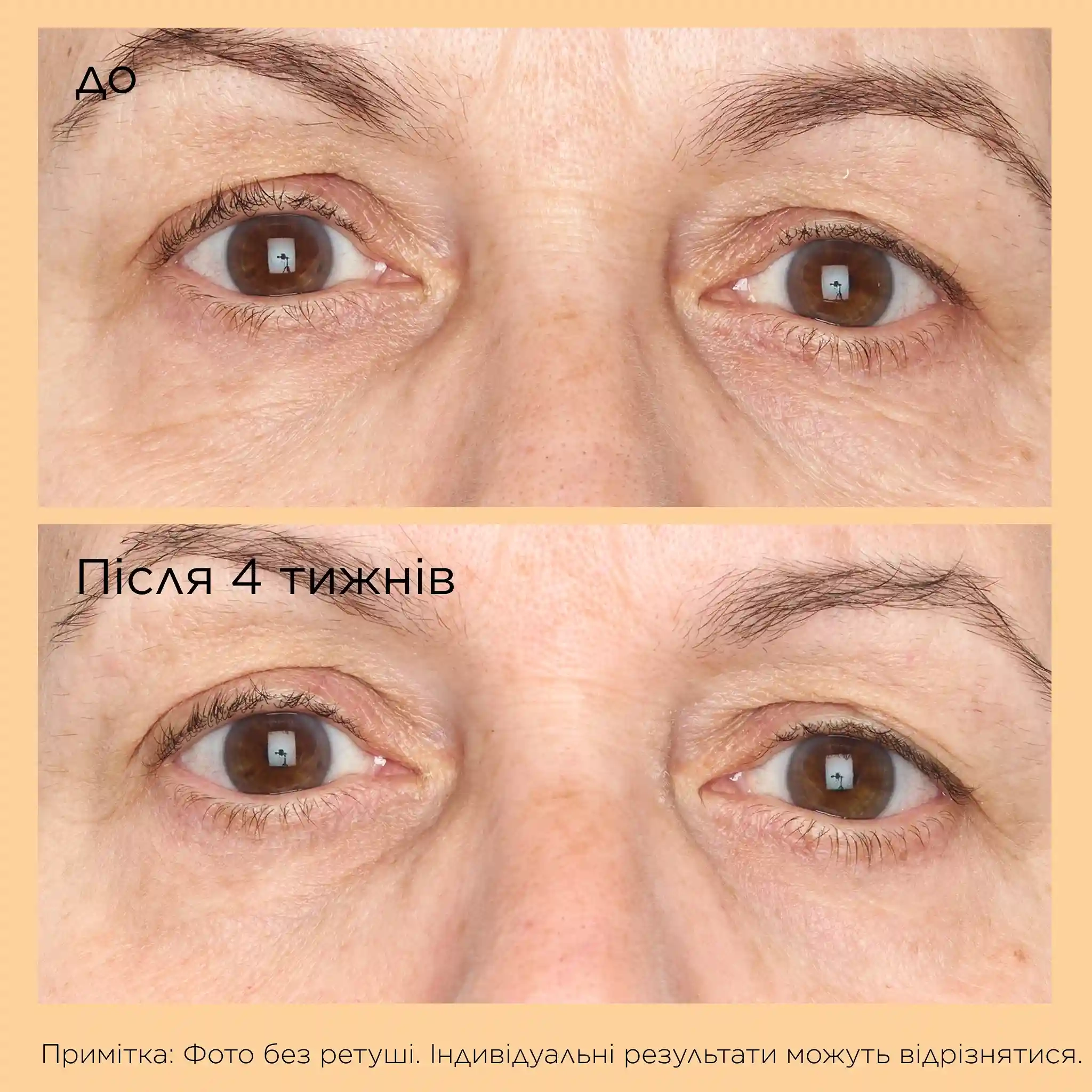 NEUROPEPTIDE CORRECTIVE BRIGHTENING UNDER-EYE CREAM - 3 - Perricone MD