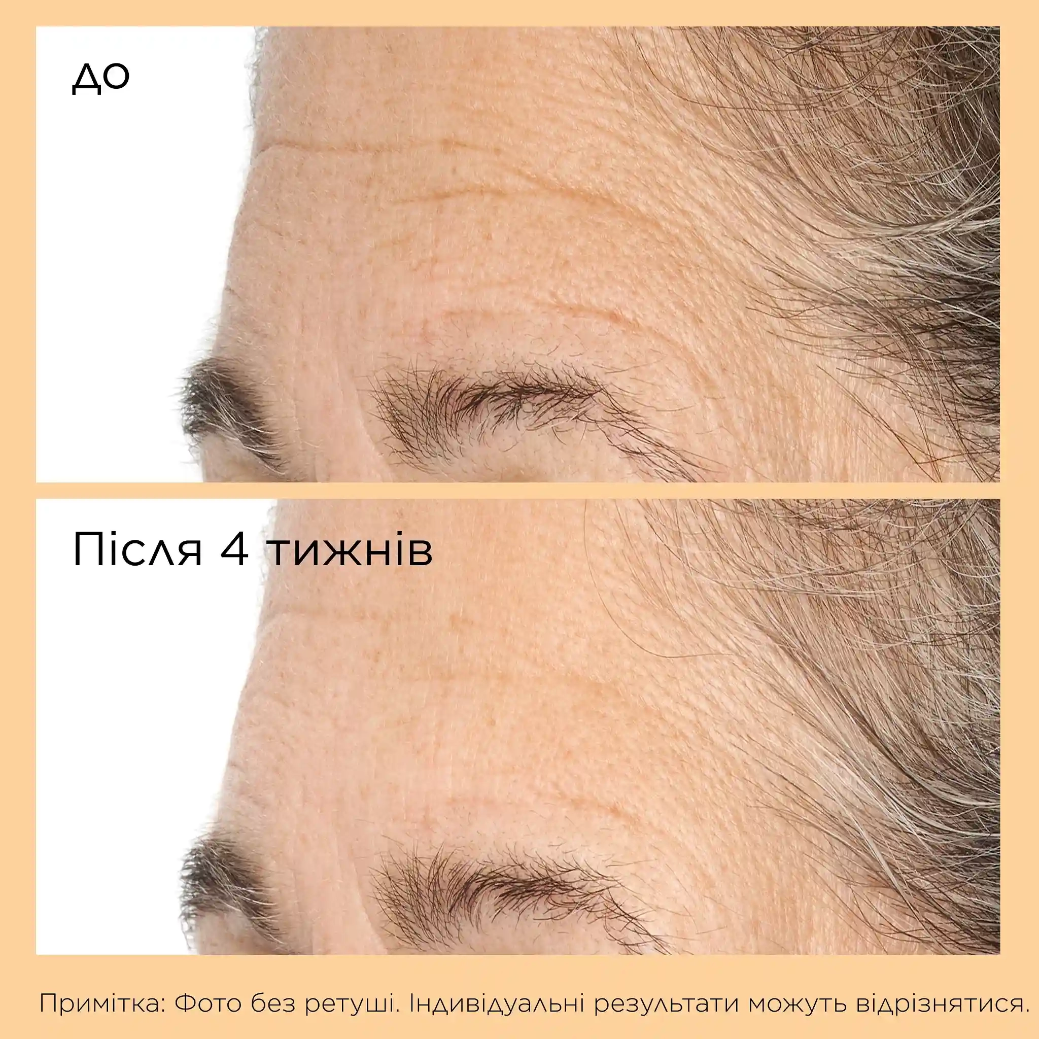 NEUROPEPTIDE DEEP CREASE SERUM - 4 - Perricone MD