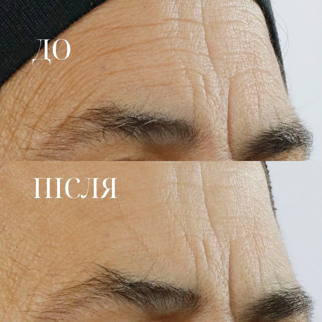 HIGH POTENCY TRIPLE RETINOL RENEWAL SERUM - 4 - Perricone MD