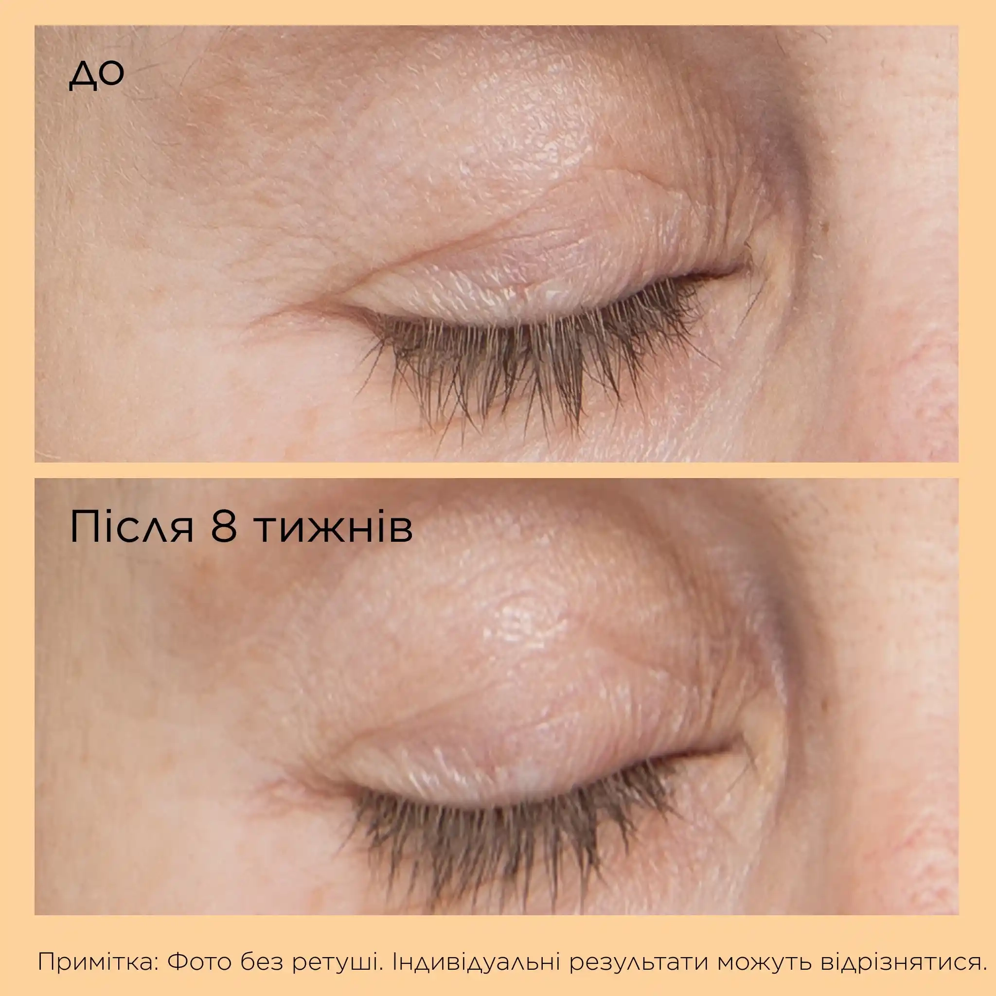 NEUROPEPTIDE EYELID LIFT SERUM - 5 - Perricone MD