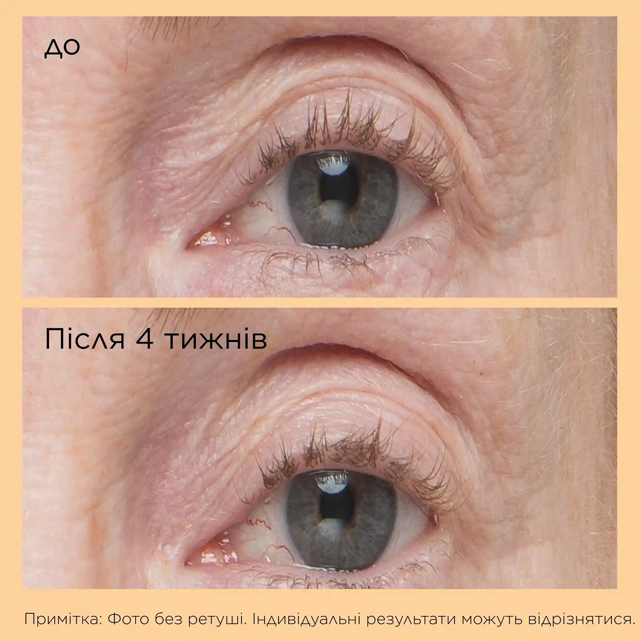 NEUROPEPTIDE EYELID LIFT SERUM - 6 - Perricone MD