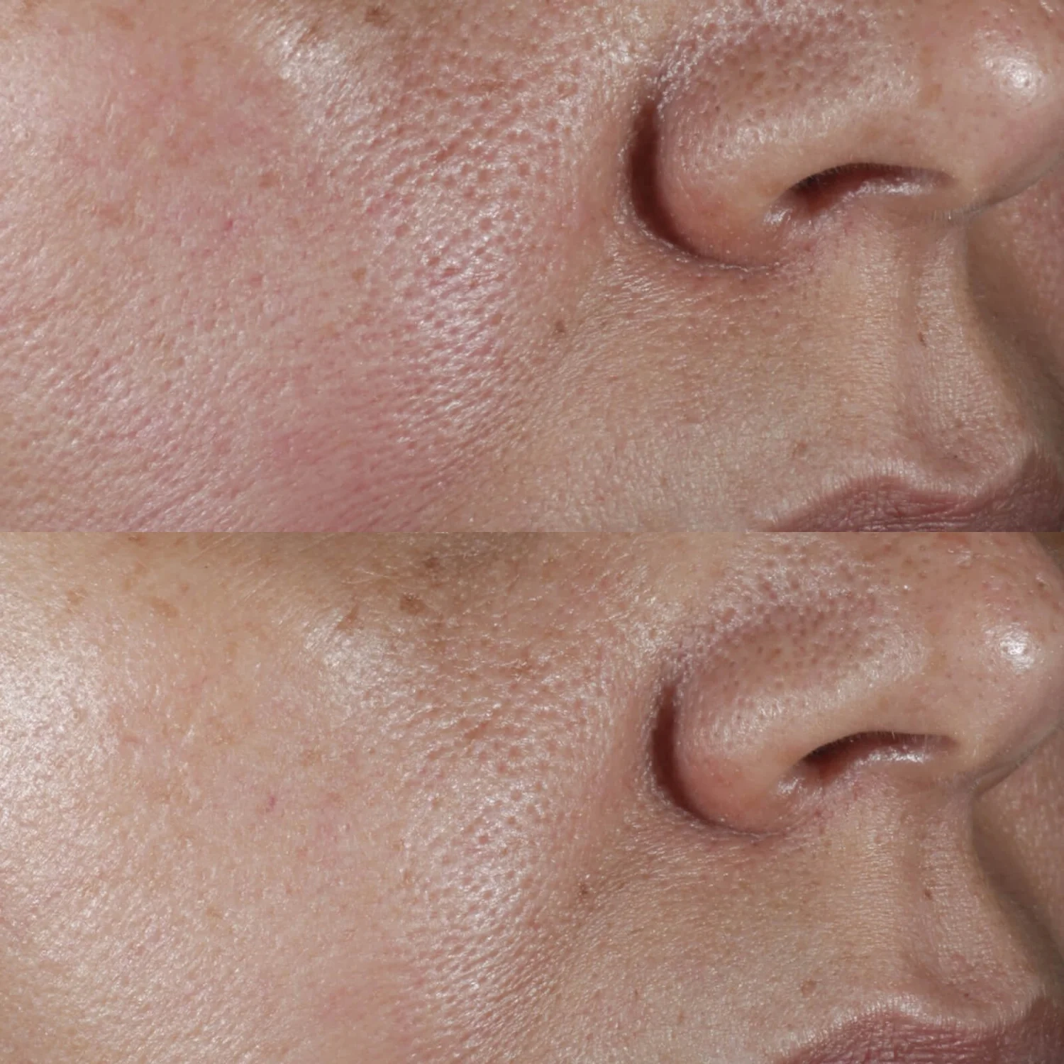 NO:RINSE INTENSIVE PORE MINIMIZING TONER - 4 - Perricone
