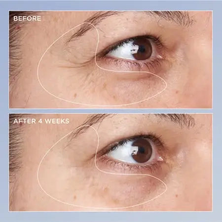 HIGH POTENCY TRIPLE RETINOL RENEWAL EYE SERUM - 4 - Perricone MD