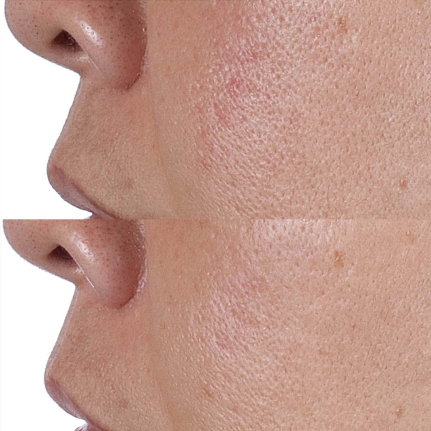 HIGH POTENCY FACE FINISHING & FIRMING TONER - 4 - Perricone MD